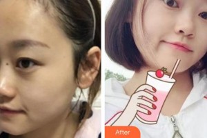 楚雄現(xiàn)代婦產(chǎn)醫(yī)院醫(yī)療美容科賈萬榮整形價格表附微針水光案例展示