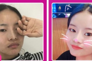 樊枝花凝美醫(yī)療美容診所宋勇整形價格表附光子嫩膚案例展示