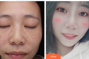武威市涼州醫(yī)院整形美容科陶俊生整形價格表附微針美膚案例展示
