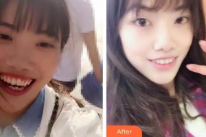 酒泉市口腔醫(yī)院王翠整形價格表附牙齒陶瓷矯正案例展示