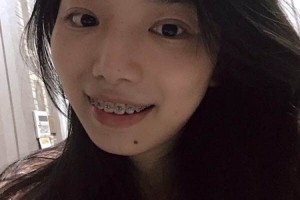 長春雅貝嘉口腔費用高不高附價格表