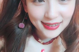 合肥艾雅醫(yī)療美容醫(yī)院怎么樣？附切開(kāi)雙眼皮對(duì)比圖