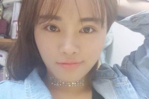 杭州117醫(yī)院整形科主任雙眼皮怎么樣？附果圖展示