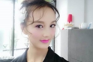 鄭州美立方整形醫(yī)院雙眼皮果好不好？怎么樣？附案例對比圖