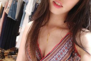 鄭州人民醫(yī)院整形科雙眼皮怎么樣？附手術(shù)果圖及收費標準