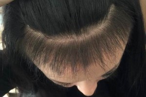 平頂山醫(yī)美整形植發(fā)手術(shù)怎么樣附價格表