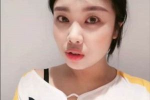 遼寧丹東金澄美容醫(yī)院光子嫩膚果，多久做一次附價格表