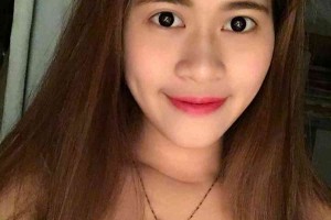 湖南株洲中心醫(yī)院整形科？雙眼皮術(shù)后注意事項(xiàng)！