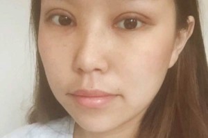 寧波第一院整容科項目好不好？科室醫(yī)生介紹！