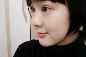 武漢天佑醫(yī)院整形雙眼皮行不行？真人圖片對比+醫(yī)生推薦