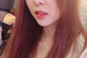 鄭州集美整形醫(yī)院隆鼻真人案例+醫(yī)生介紹！