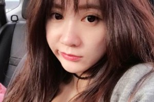 天津一中心整形外科隆鼻怎么樣？真人案例+醫(yī)生介紹