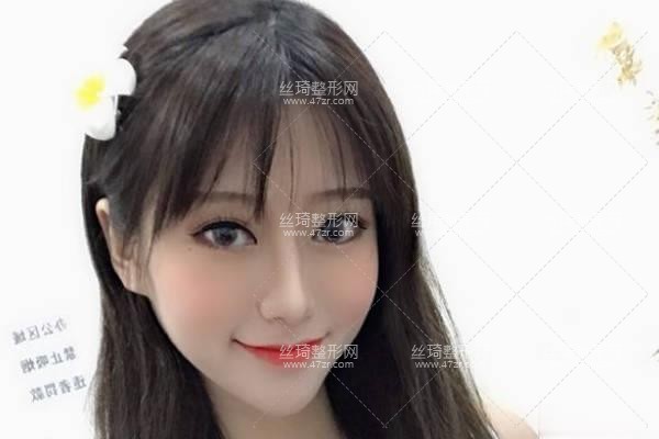 寧波第三醫(yī)院整形美容科怎么樣？鼻部手術(shù)價(jià)目表和醫(yī)生推薦