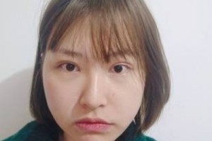 麗港醫(yī)療美容整形醫(yī)院怎么樣？醫(yī)生推薦