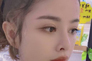 青醫(yī)附院環(huán)境好不好？雙眼皮案例&2021價格表！