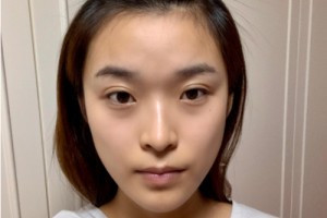 合肥曙光醫(yī)院植發(fā)怎么樣？附2021價(jià)格表