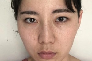 泰安中心醫(yī)院美容科怎么樣/激光祛斑測(cè)評(píng)點(diǎn)評(píng)!