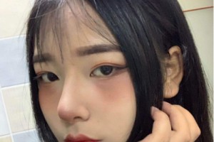 鄭州二附院整形科隆鼻果？手術(shù)案例實(shí)拍