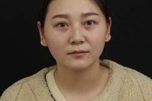 鄭州天后醫(yī)院隆鼻整形正規(guī)嗎？醫(yī)院簡(jiǎn)介—醫(yī)生名單