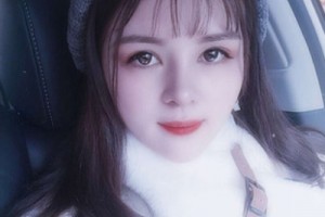 北京協(xié)和醫(yī)院整形外科價格？假體隆鼻術后恢復！