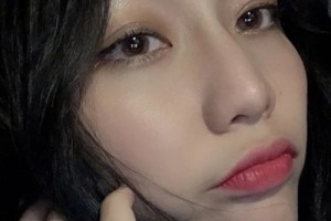 米格醫(yī)療美容醫(yī)院假體隆鼻果？案例+價格表