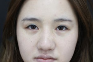 301整形科好不好？醫(yī)院介紹+2021超全價(jià)格表