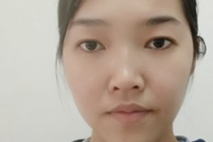 吉大一院美容科在線咨詢|美白皮膚&較大優(yōu)惠