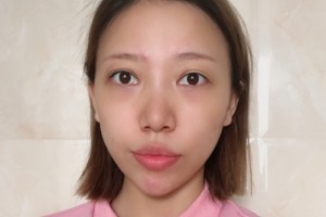 廣州善伊整形口碑如何？醫(yī)生名單+較新費(fèi)用表優(yōu)惠