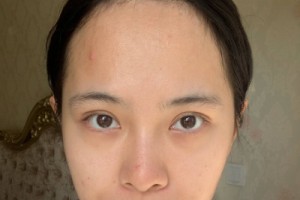 上海九院整形科植發(fā)？掛號難不難網(wǎng)上掛號攻略