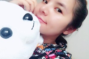 新橋醫(yī)院美容科隆鼻果如何？附術(shù)后圖+價(jià)格表