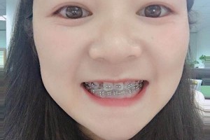 沈陽(yáng)康貝佳口腔牙齒矯正怎么樣/醫(yī)生介紹+名單！