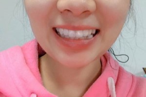 長沙市口腔醫(yī)院牙齒矯正多少錢？案例測評+價(jià)格表
