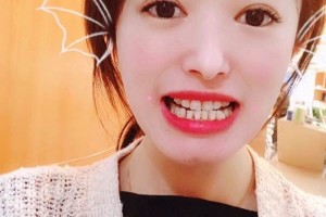 南京雅度口腔醫(yī)院怎么？術(shù)后反饋+醫(yī)生介紹