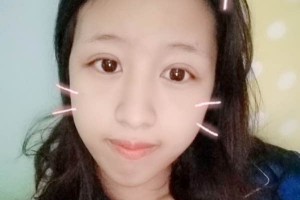 北京愉悅醫(yī)美雙眼皮口碑？醫(yī)院簡(jiǎn)介+案例