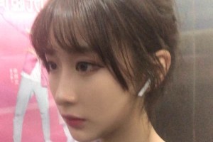 鄭州第一附院整形科靠譜嗎？下頜角真實案例圖