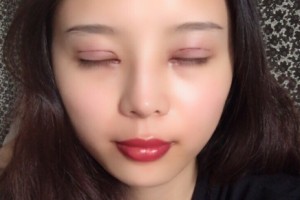 西安星伊美醫(yī)療整形怎么樣？附醫(yī)院簡(jiǎn)介+雙眼皮日記
