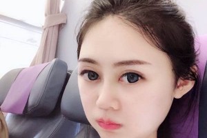 長沙葉子下頜角整形價(jià)格表？醫(yī)院介紹+醫(yī)生名單！