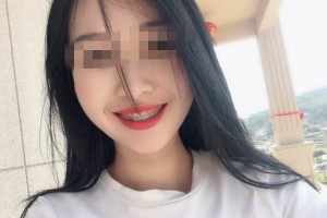 深圳福華口腔是正規(guī)醫(yī)院？牙齒矯正術(shù)案例|醫(yī)生口碑