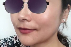 杭州邵逸夫醫(yī)院美容科下頜角好嗎？醫(yī)生介紹！