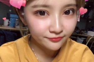 河北省中醫(yī)院美容科切開雙眼皮怎樣？真實案例分享！