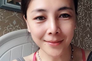 鄭州華領(lǐng)整形醫(yī)院硅膠隆鼻評價/術(shù)前術(shù)后果對比！