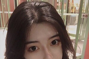 廈門新生毛發(fā)醫(yī)院是正規(guī)嗎？植發(fā)案例+醫(yī)院介紹