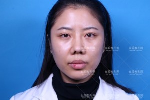 溫州附二醫(yī)激光美容科怎么樣？附案例圖+價格