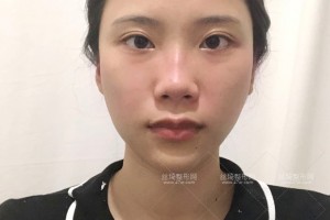 杭州浙一醫(yī)院有做熱瑪吉嗎？附果圖+價格表