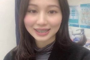 濟(jì)南圣貝口腔醫(yī)院牙齒矯正怎么樣/真實(shí)案例對(duì)比！