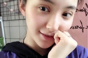 上海千美醫(yī)療美容院定點雙眼皮？術(shù)后術(shù)前明X果～