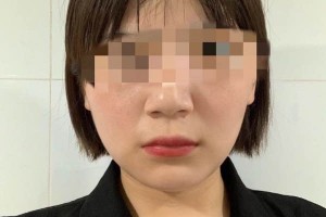 遵義韓美整形醫(yī)院下頜角靠譜嗎？醫(yī)生名單介紹！