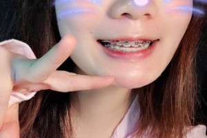 長(zhǎng)沙中諾口腔醫(yī)院/牙齒矯正圖片對(duì)比！