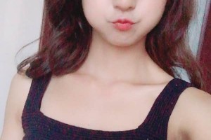盛京醫(yī)院的整形科切開(kāi)雙眼皮怎么樣？醫(yī)生推薦