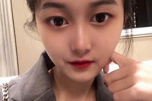 廣州中山三院整形科？下頜角案例介紹+醫(yī)生推薦